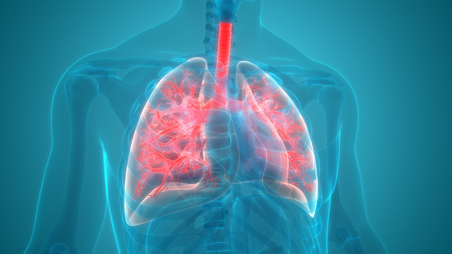 Community acquired pneumonia: diagnosis and management in adults